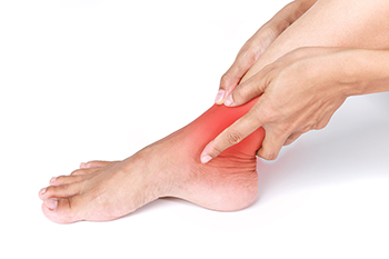 Tarsal Tunnel Syndrome