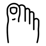 ToenailFungus