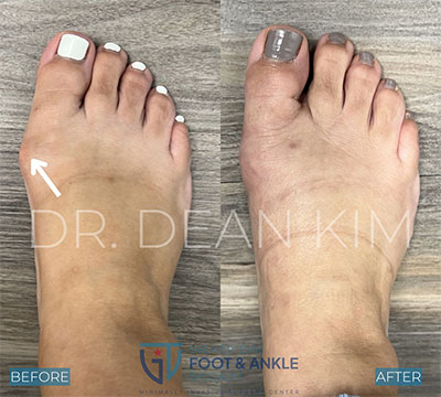 mis before and after10