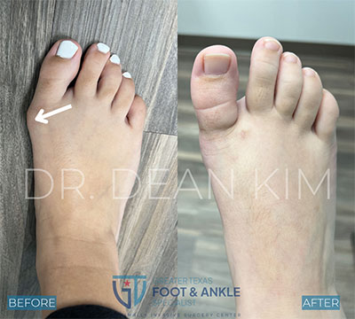 mis before and after12