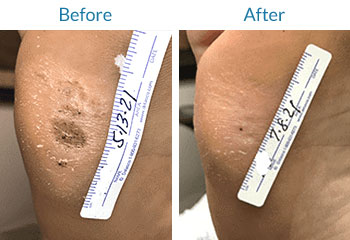 swift-before-and-after-01