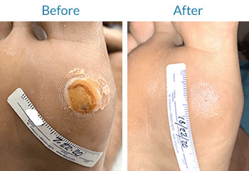 swift-before-and-after-02
