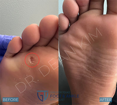 swift before and after002