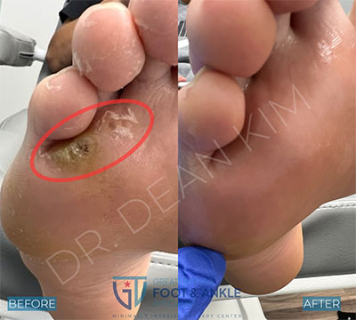swift before and after009