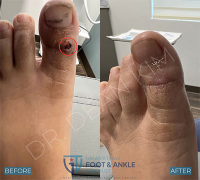swift before and after10