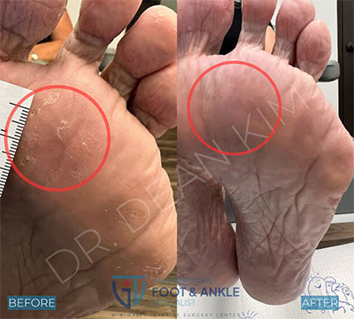 swift before and after15