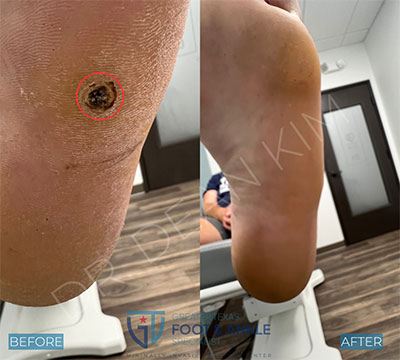 swift before and after16