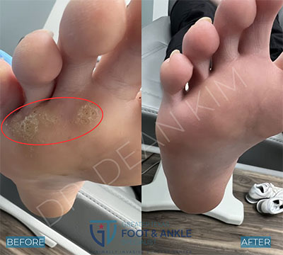 swift before and after17