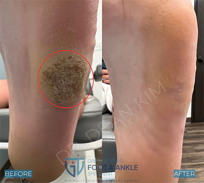 swift before and after20