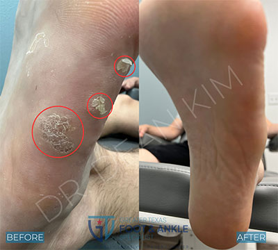 swift before and after22
