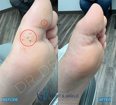 swift before and after25