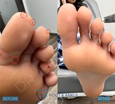 swift before and after27